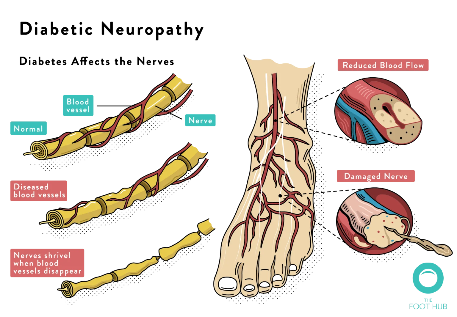 diabetic-foot-assessment-the-foot-hub-diabetic-podiatrist