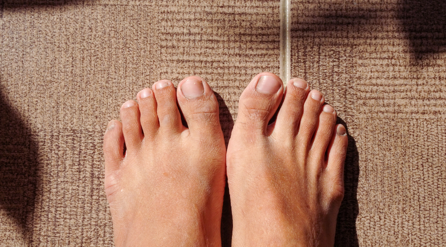 clear toenails